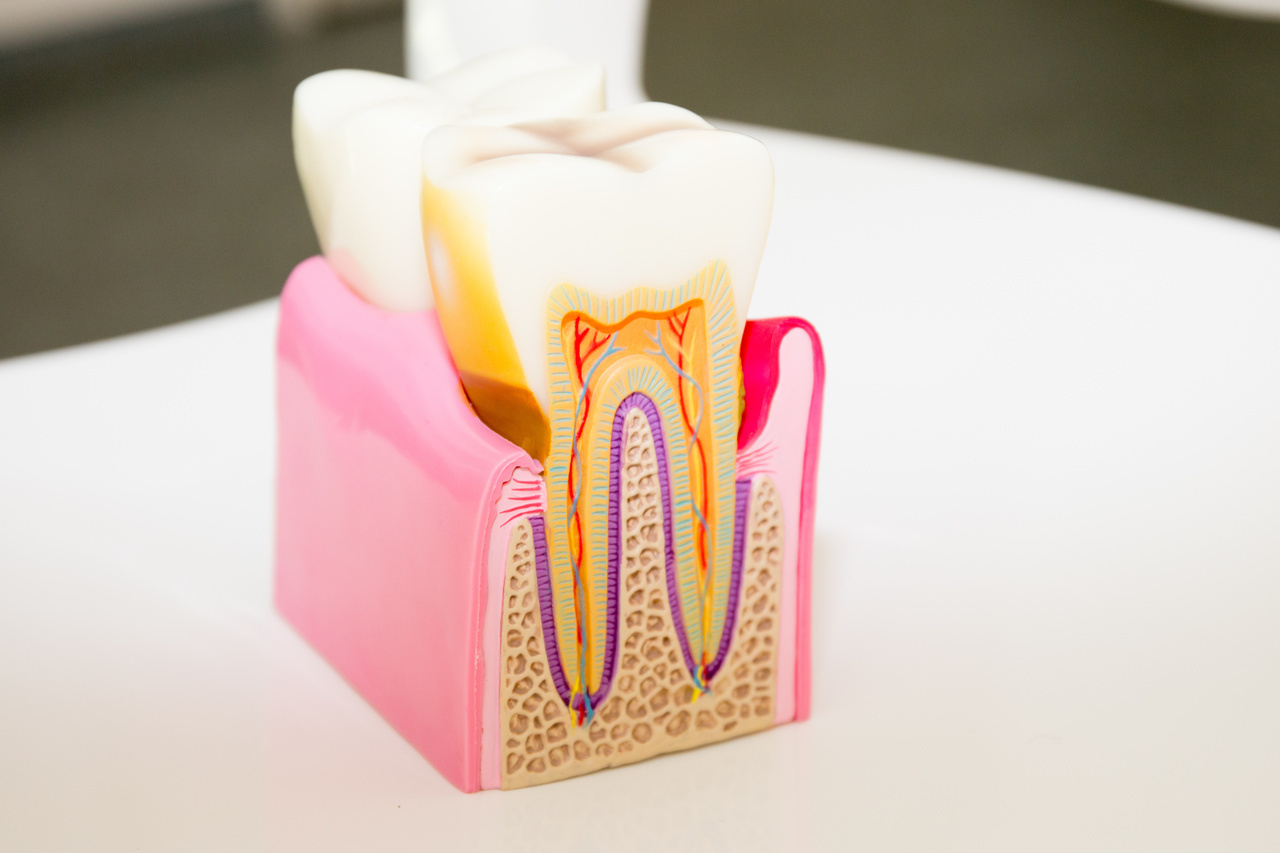 歯の中身の模型